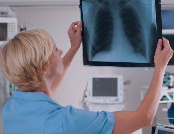 A doctor looking at an xray of a patient's chest.