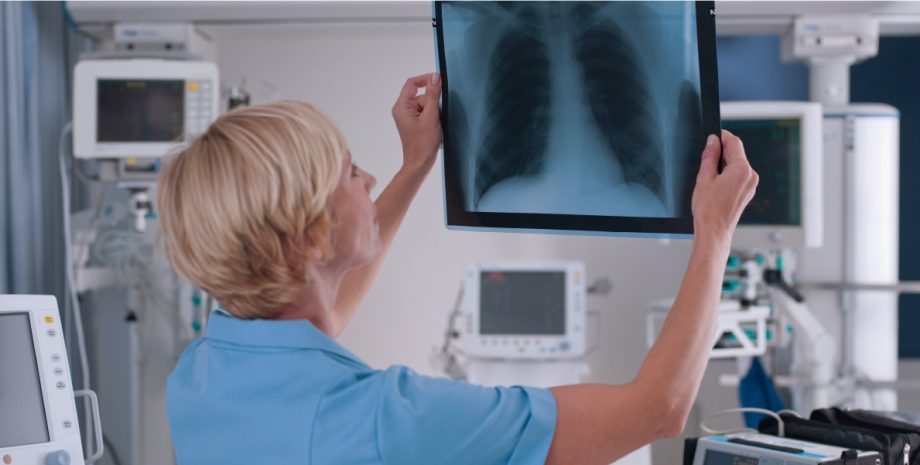 A doctor looking at an xray of a patient's chest.