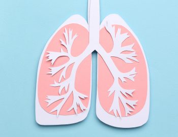 lung cancer